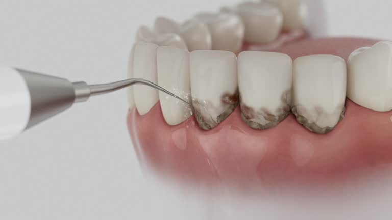 Trusted Dental Crowns And Bridges service in Burtonsville, MD - Dentist Open Now